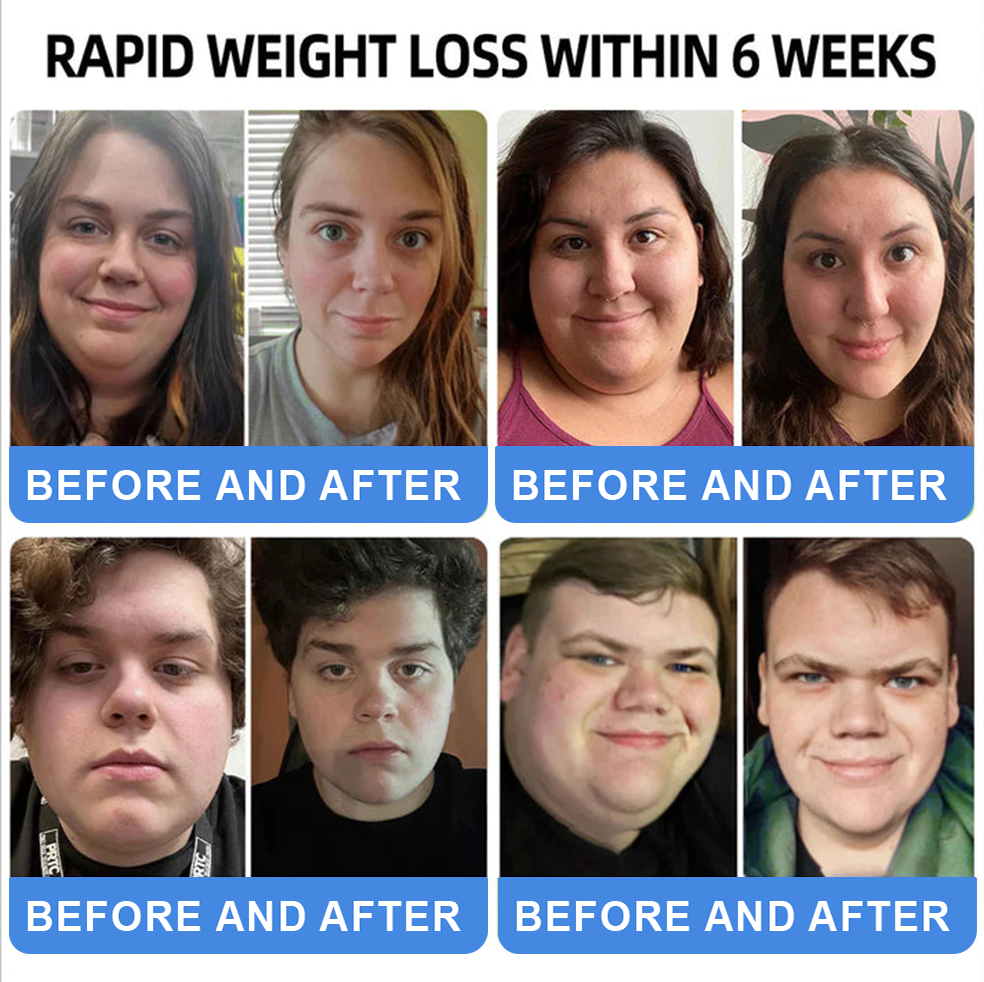 ãLast Day Promotion 66% OFFð¥ã ðªðð ððð® GLP-1-Tirzepatide Oral Solution ðºðžðªvisible effect, no side 7 days effects, suitable for all age groupsð
