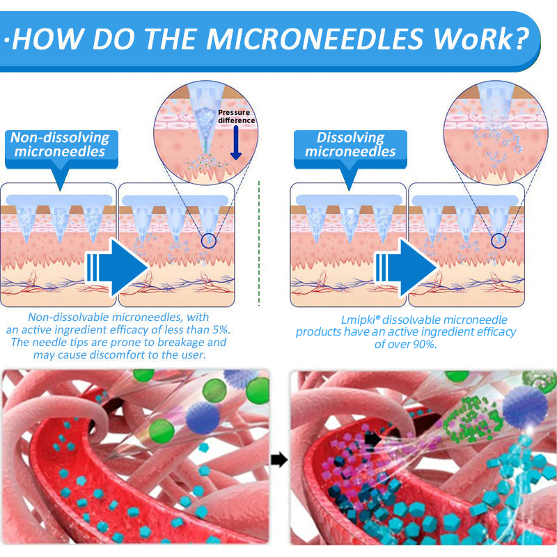 🍀【𝙎𝙪𝙢𝙢𝙚𝙧 𝙇𝙞𝙢𝙞𝙩𝙚𝙙 𝙀𝙙𝙞𝙩𝙞𝙤𝙣】🍀 𝗟𝗺𝗶𝗽𝗸𝗶® 🇺🇸 Nano Microneedle Patch with SMGT-GLP-1 & Matrixyl 3000 – Slimming, Skin Tightening, Blood Sugar Support, No Injection, 7-Day Result😍