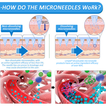 🍀【𝙎𝙪𝙢𝙢𝙚𝙧 𝙇𝙞𝙢𝙞𝙩𝙚𝙙 𝙀𝙙𝙞𝙩𝙞𝙤𝙣】🍀 𝗟𝗺𝗶𝗽𝗸𝗶® 🇺🇸 Nano Microneedle Patch with SMGT-GLP-1 & Matrixyl 3000 – Slimming, Skin Tightening, Blood Sugar Support, No Injection, 7-Day Result😍