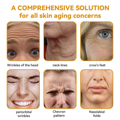 EQVP® 𝘽𝙀𝙀 𝙑𝙀𝙉𝙊𝙈 𝑺𝒌𝒊𝒏 𝑹𝒆𝒔𝒕𝒐𝒓𝒂𝒕𝒊𝒐𝒏 𝑪𝒓𝒆𝒂𝒎 –🌸 Anti-aging,Hydrating, Skin Repair, Even Tone, Acne and Dark Spot Treatment, Wart and Mole Removal, Psoriasis Relief