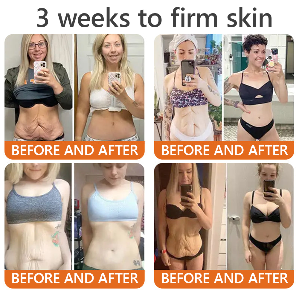 EQVP® 𝘽𝙀𝙀 𝙑𝙀𝙉𝙊𝙈 𝑺𝒌𝒊𝒏 𝑹𝒆𝒔𝒕𝒐𝒓𝒂𝒕𝒊𝒐𝒏 𝑪𝒓𝒆𝒂𝒎 –🐝 Anti-aging,Hydrating, Skin Repair, Even Tone, Acne and Dark Spot Treatment, Wart and Mole Removal, Psoriasis Relief