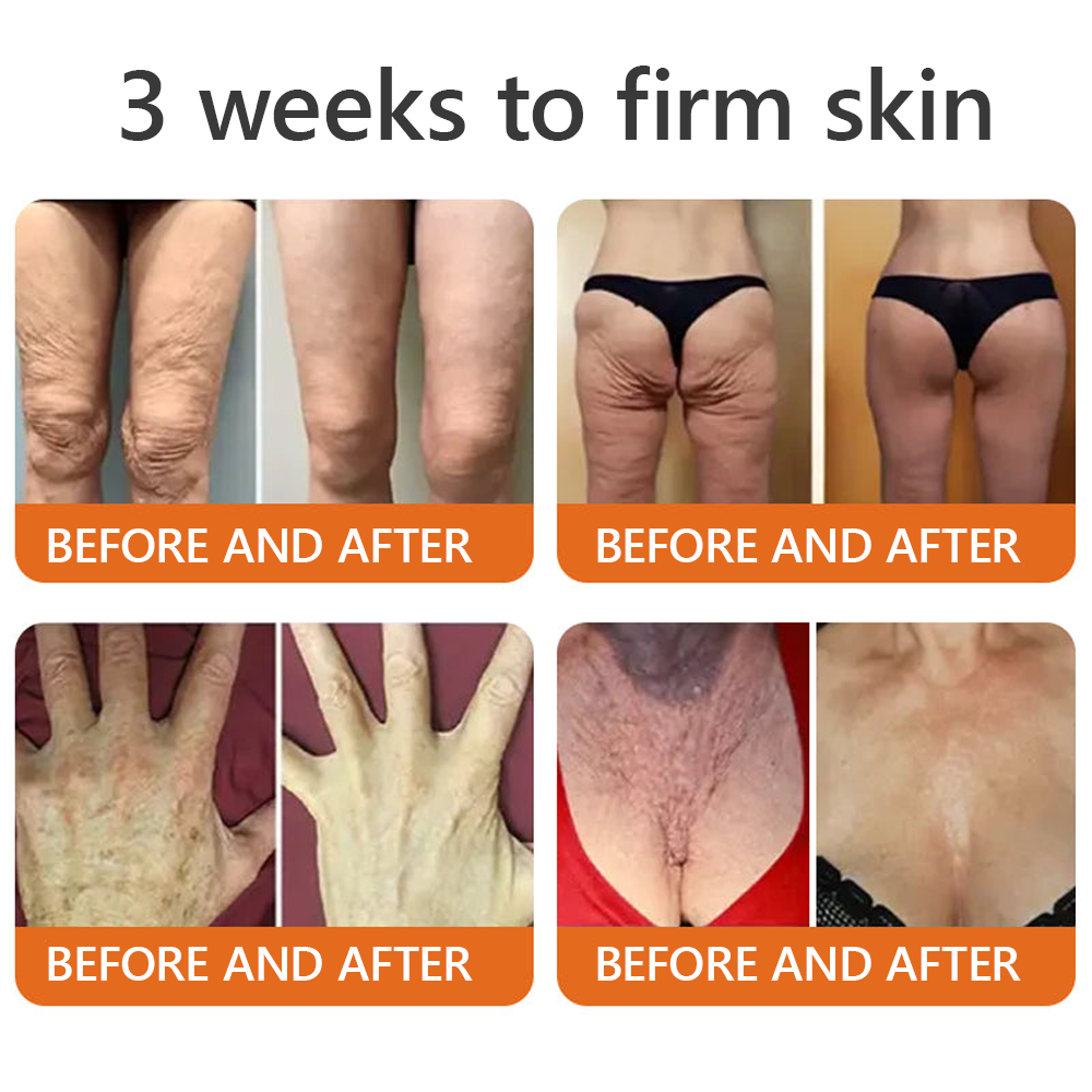EQVP® 𝘽𝙀𝙀 𝙑𝙀𝙉𝙊𝙈 𝑺𝒌𝒊𝒏 𝑹𝒆𝒔𝒕𝒐𝒓𝒂𝒕𝒊𝒐𝒏 𝑪𝒓𝒆𝒂𝒎 –🌸 Anti-aging,Hydrating, Skin Repair, Even Tone, Acne and Dark Spot Treatment, Wart and Mole Removal, Psoriasis Relief