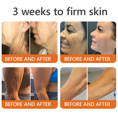 EQVP® 𝘽𝙀𝙀 𝙑𝙀𝙉𝙊𝙈 𝑺𝒌𝒊𝒏 𝑹𝒆𝒔𝒕𝒐𝒓𝒂𝒕𝒊𝒐𝒏 𝑪𝒓𝒆𝒂𝒎 –🌸 Anti-aging,Hydrating, Skin Repair, Even Tone, Acne and Dark Spot Treatment, Wart and Mole Removal, Psoriasis Relief